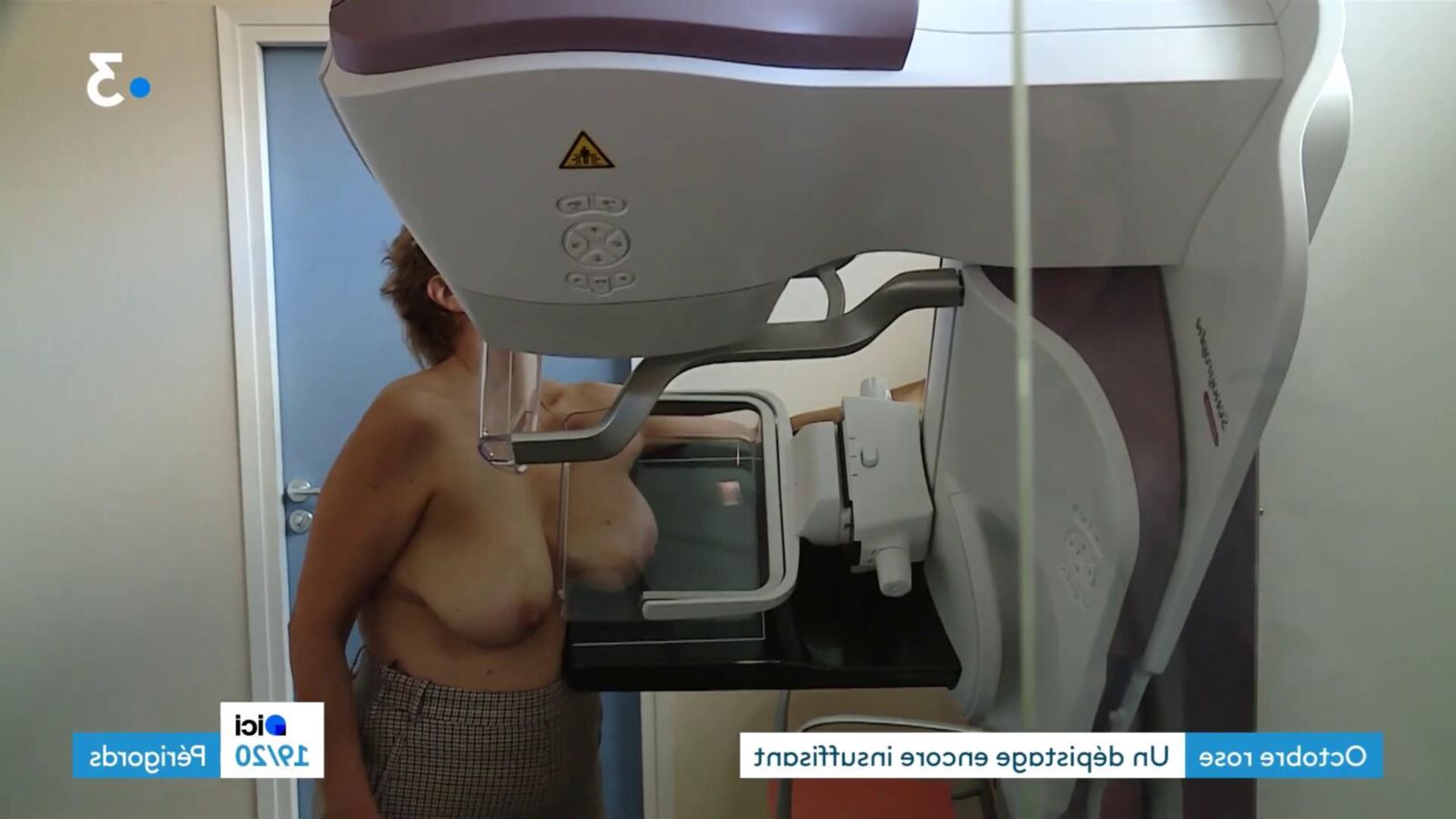 French Mature Ladies Having a Mammogram