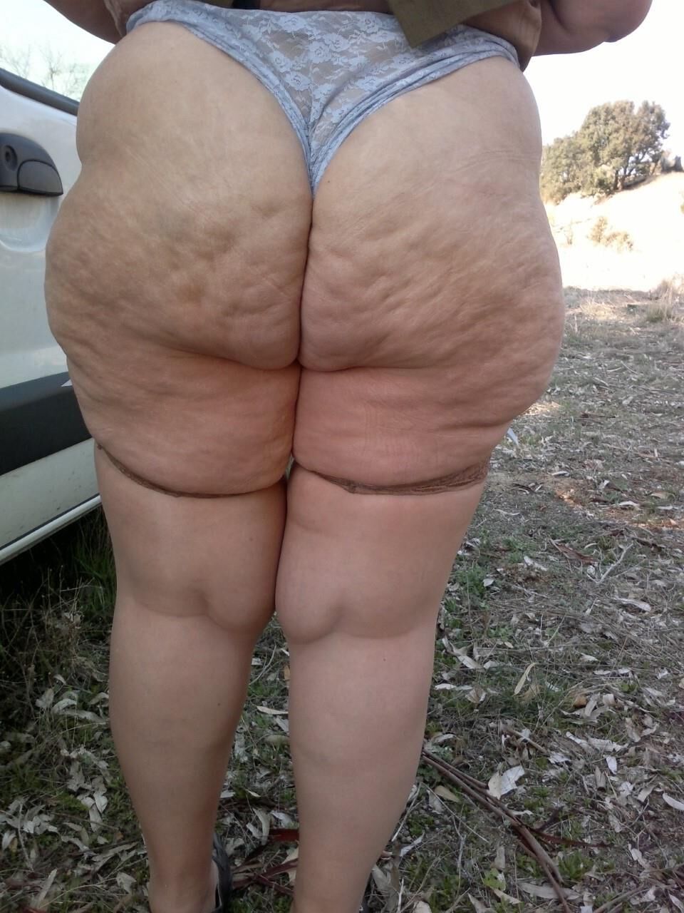 Cellulite asses and thighs