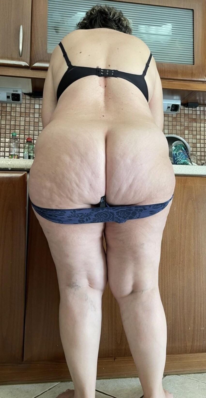 Cellulite am Po und an den Oberschenkeln