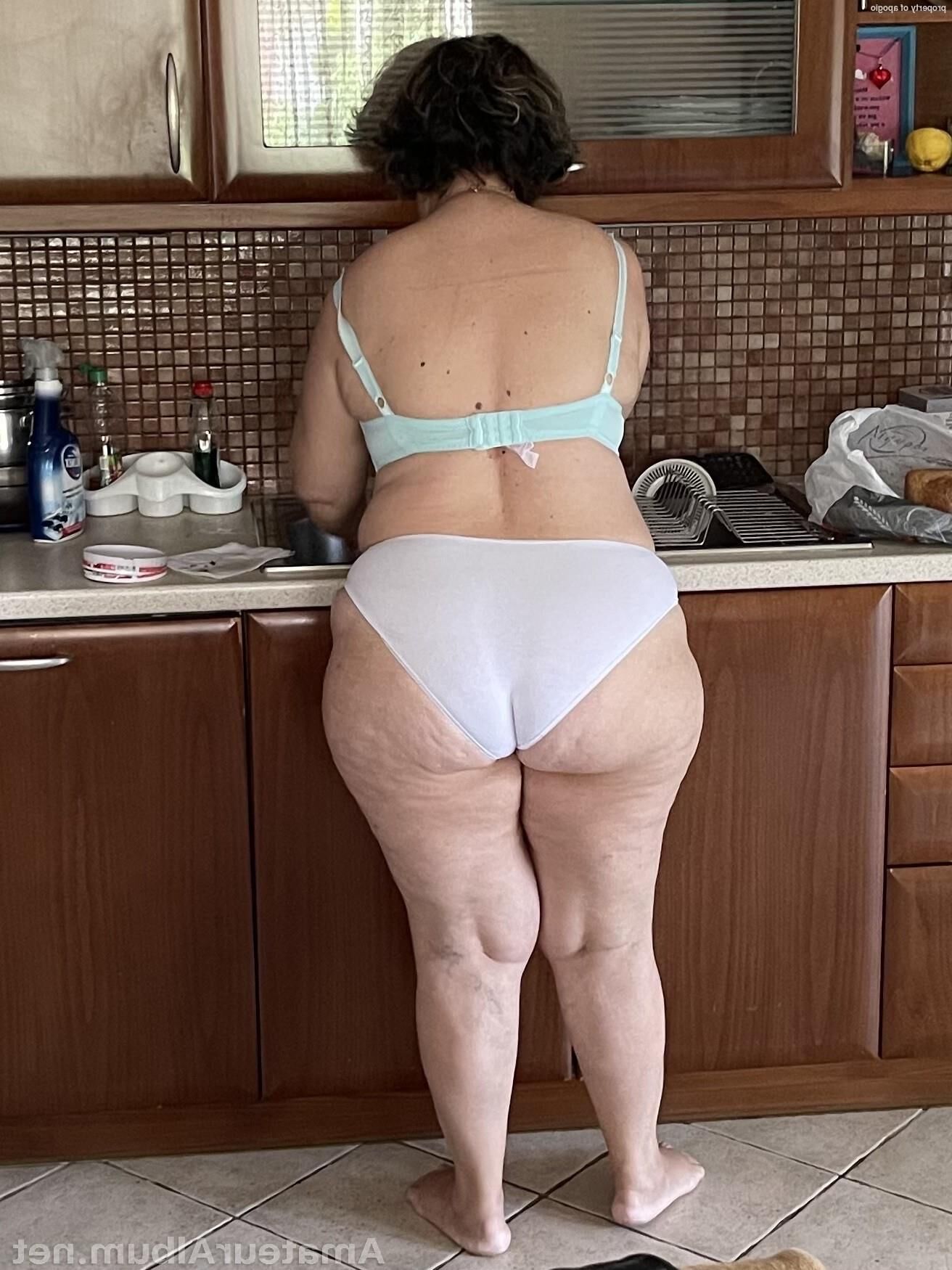 Cellulite asses and thighs ()