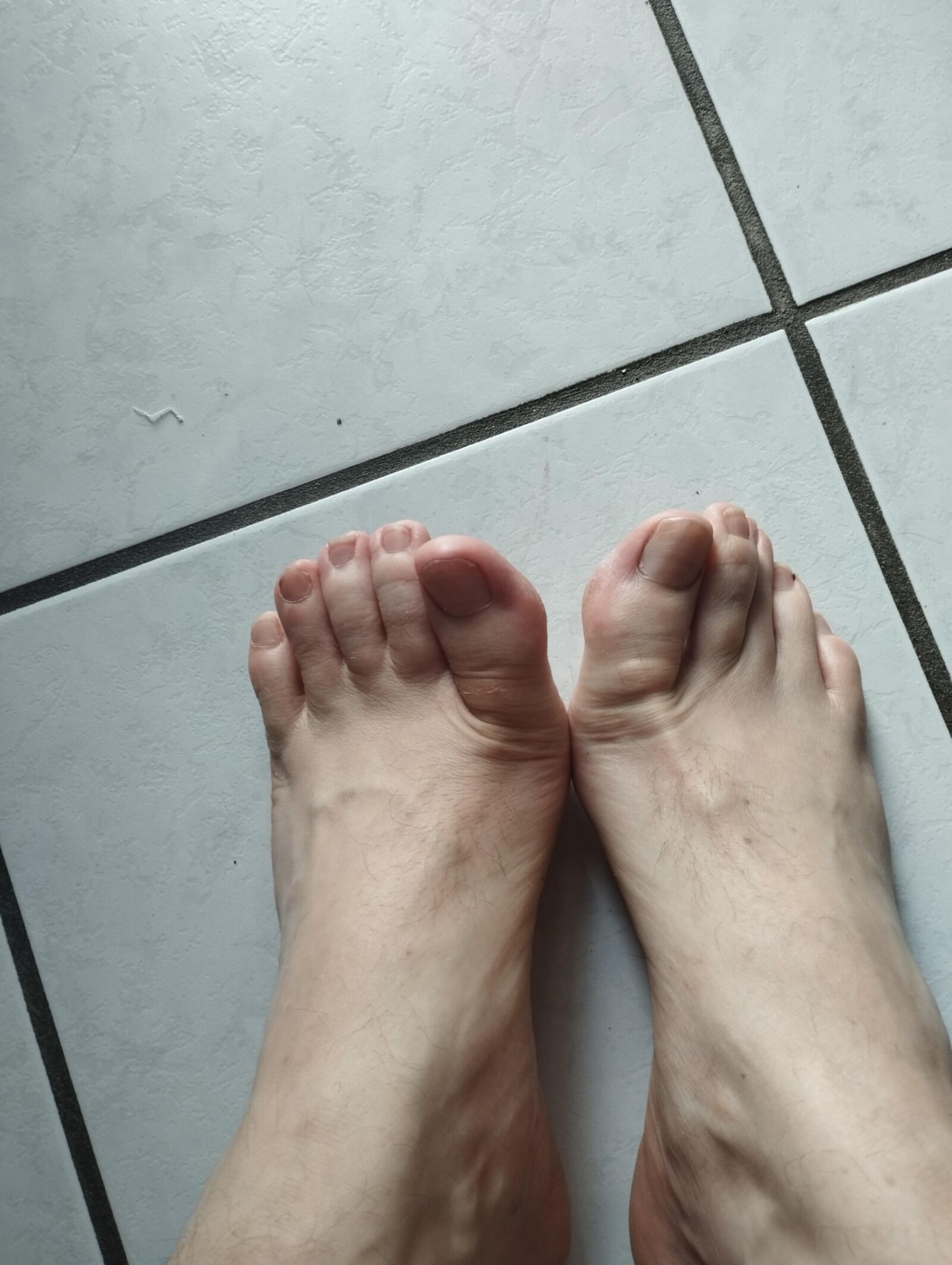 mis pies