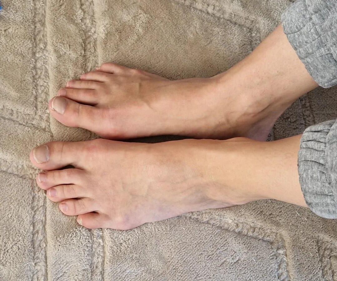 Natural toes to die for 