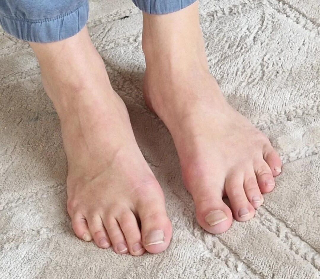 Natural toes to die for 