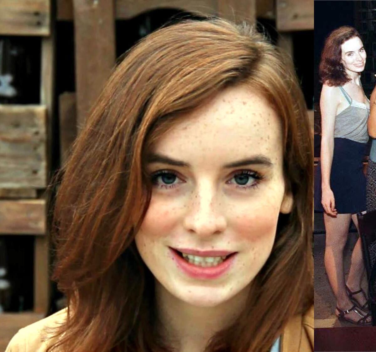 freckled pale ginger