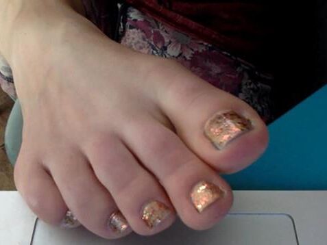 Littlekissmuffin's Toes