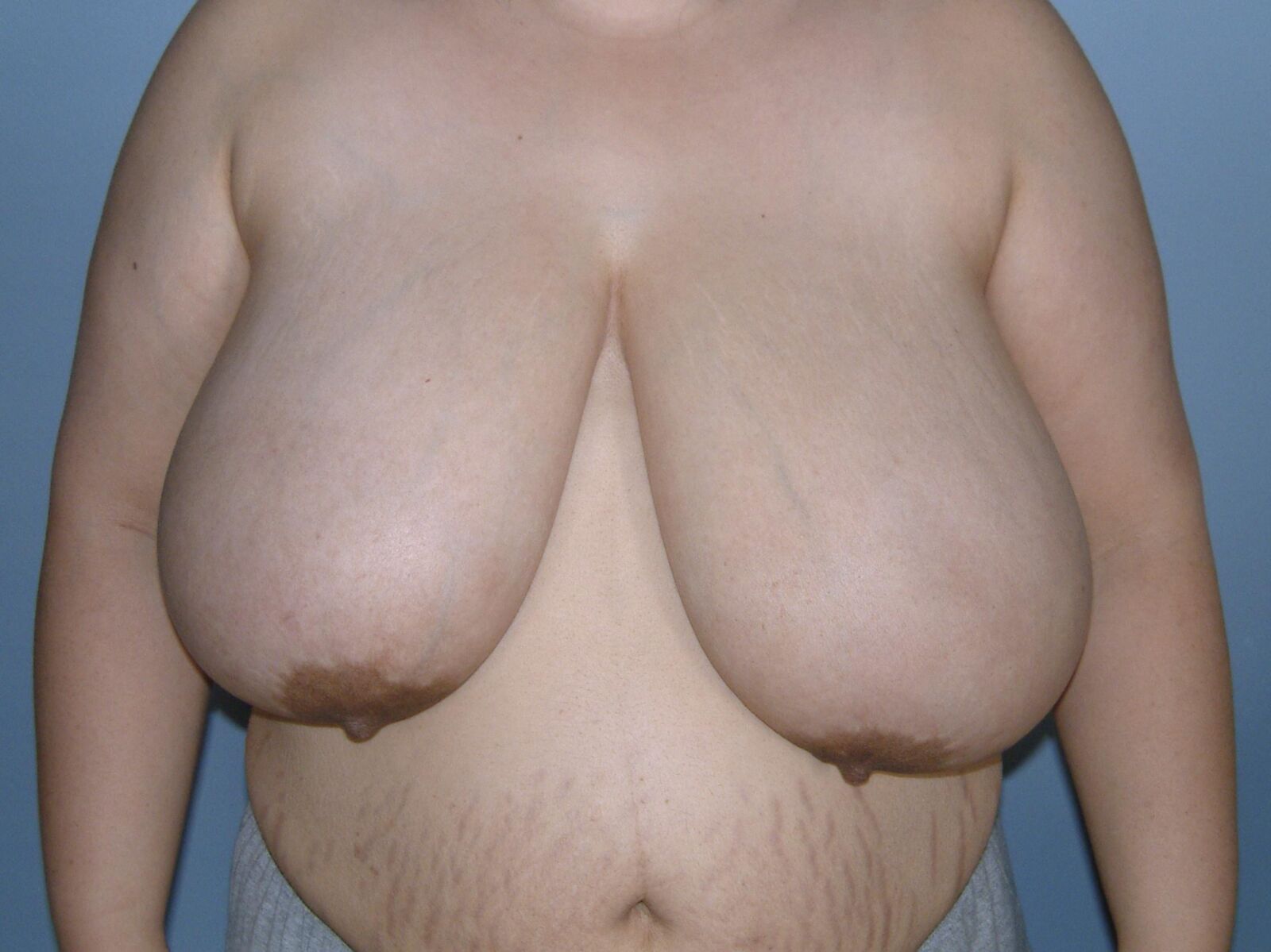 Tits So Sagging Her Nipples Point Down