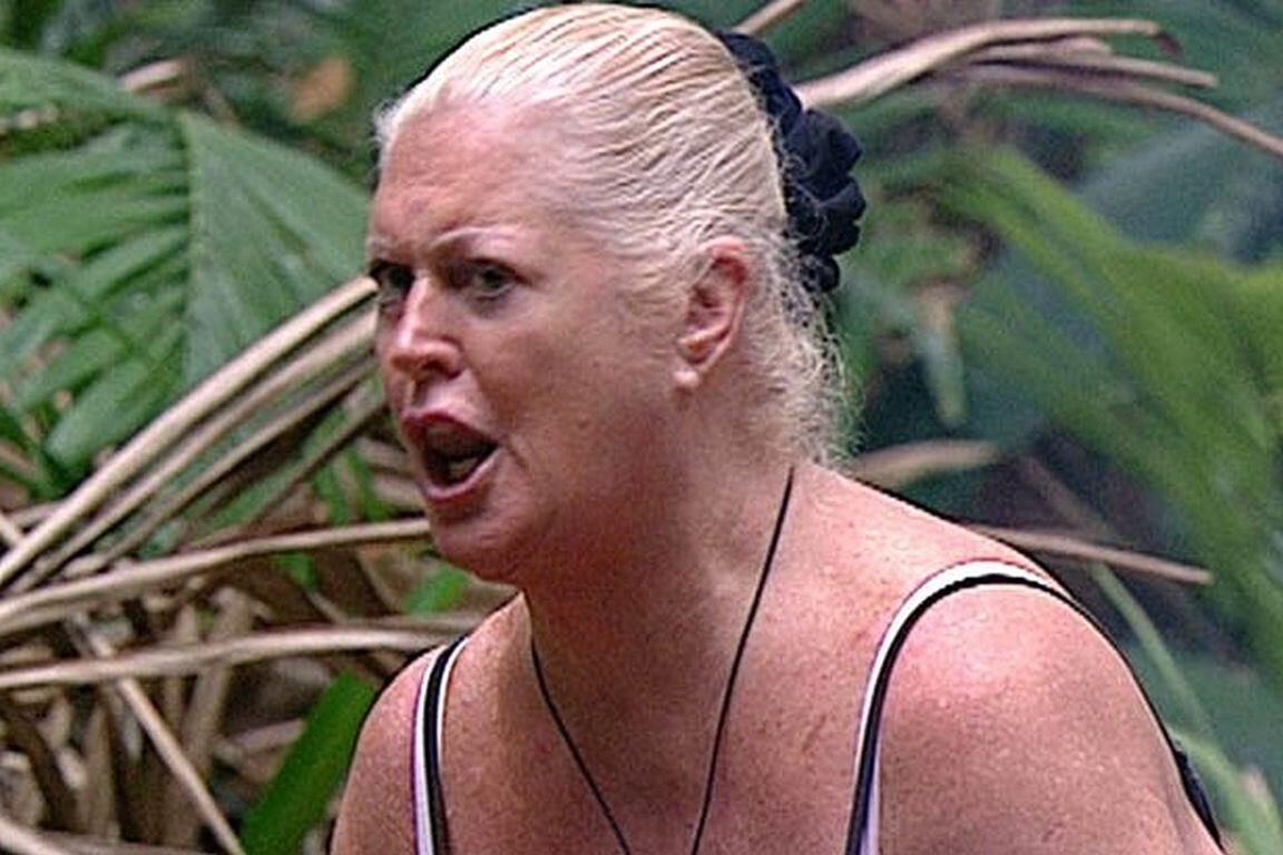 KIM WOODBURN
