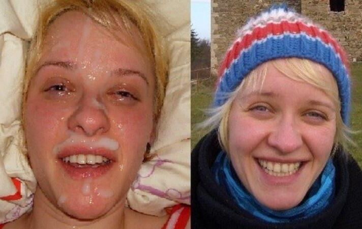 Antes e depois do OMG