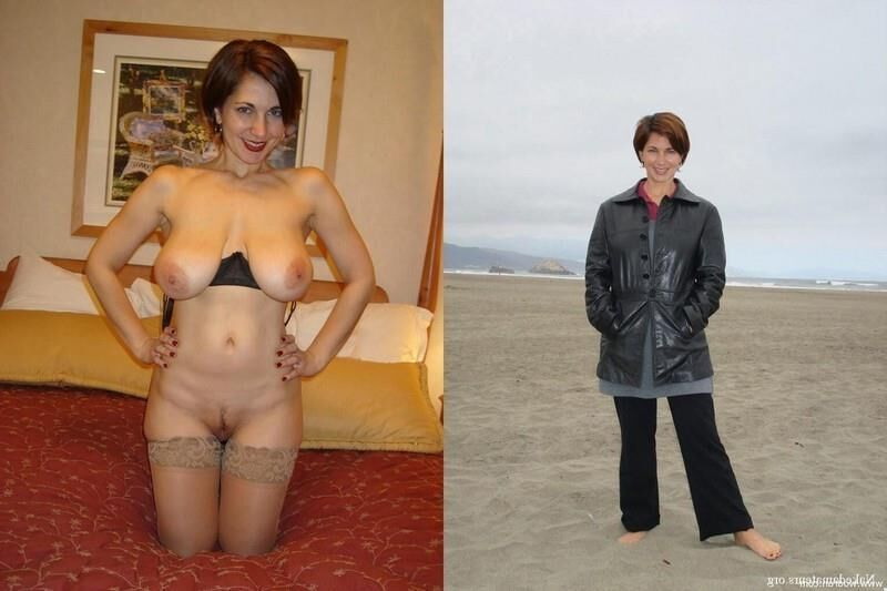 Antes e depois do OMG