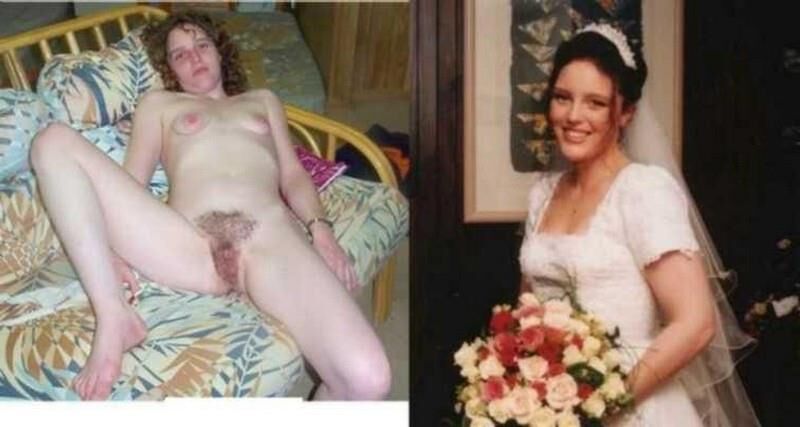 Before and After OMG 