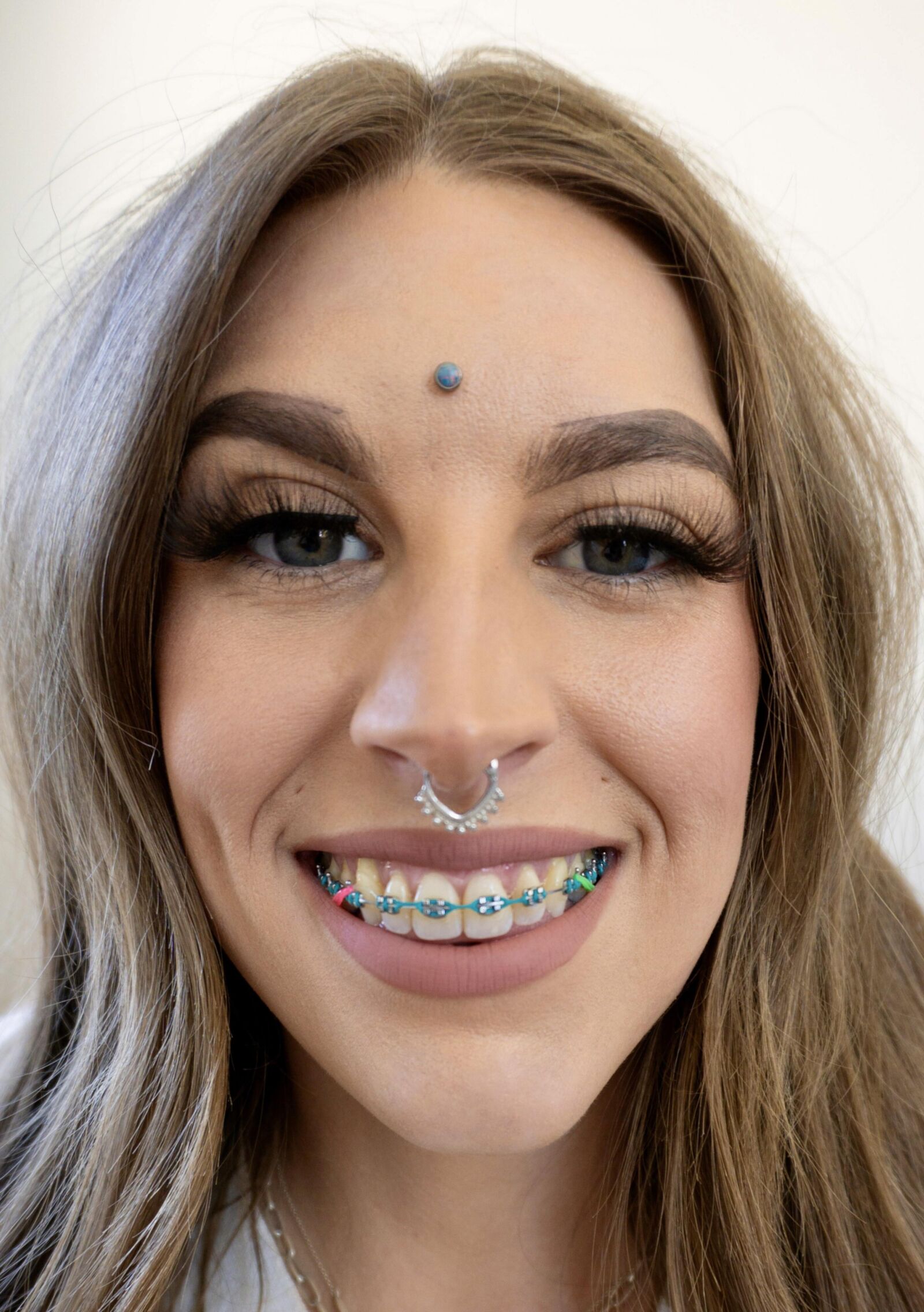 Brace Face Slut 