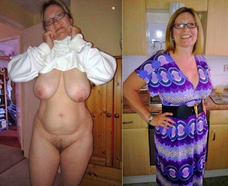 Before and After OMG 