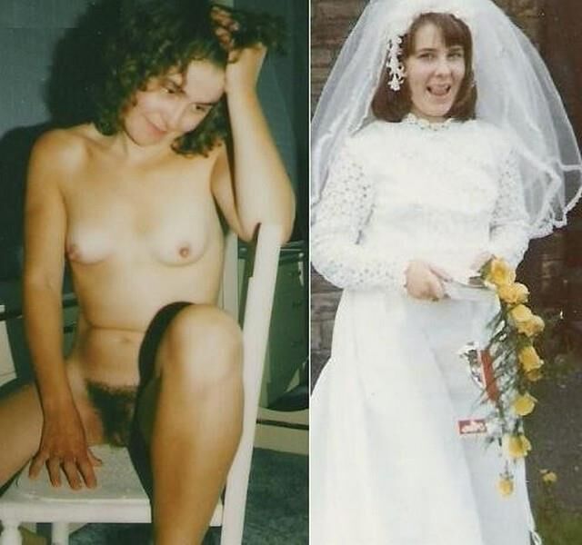 Before and After OMG 