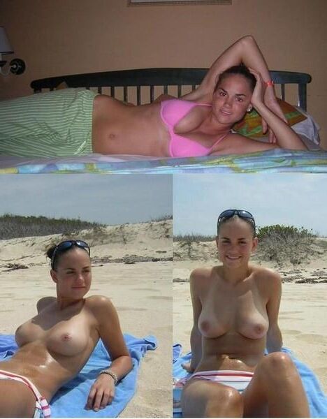 Before and After OMG 