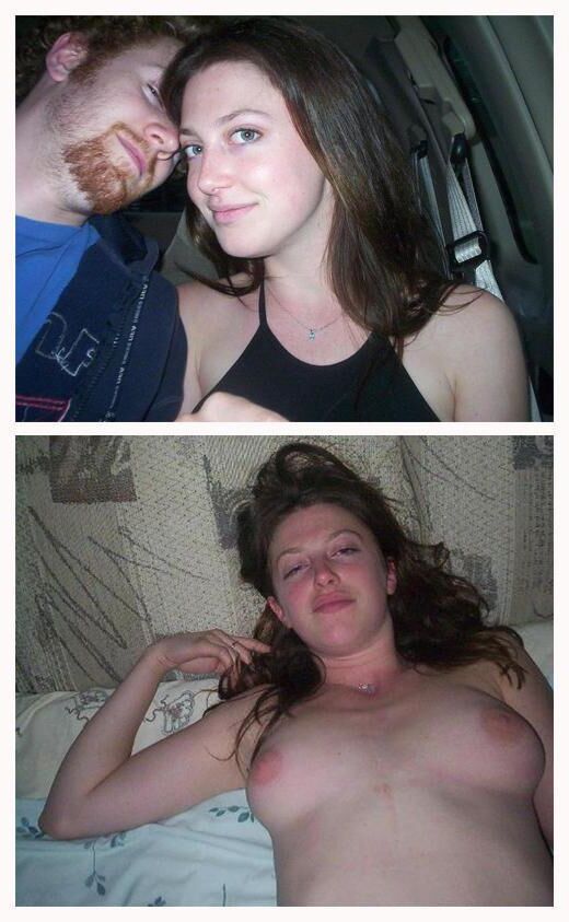 Before and After OMG 