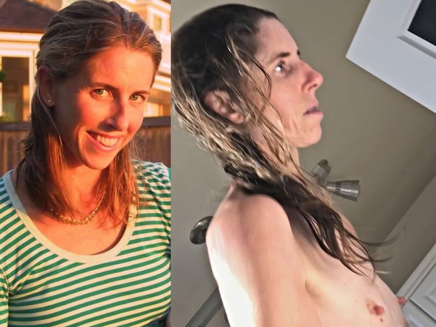Before and After OMG 