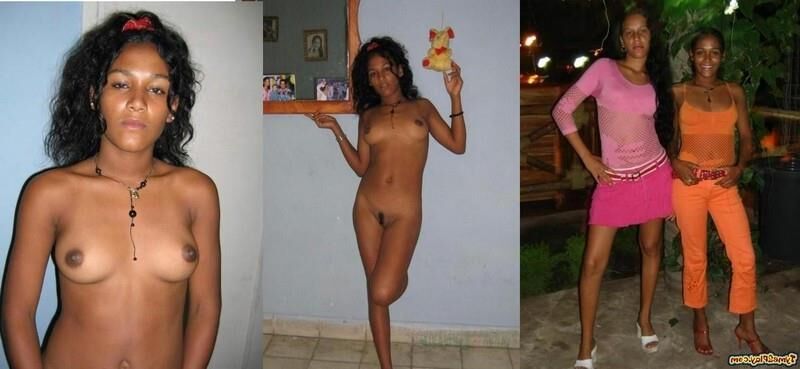 Before and After OMG 