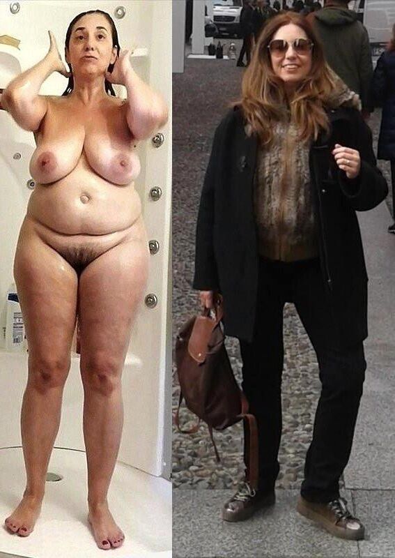Before and After OMG 