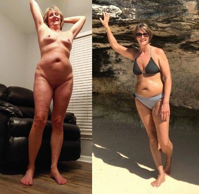 Before and After OMG 