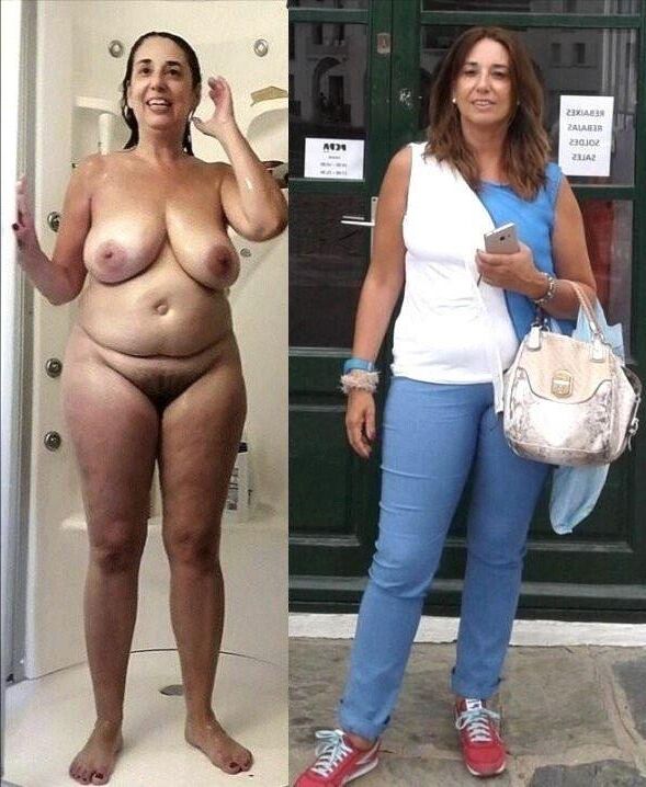 Before and After OMG 