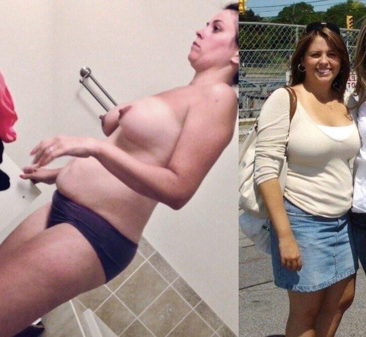 Before and After OMG 