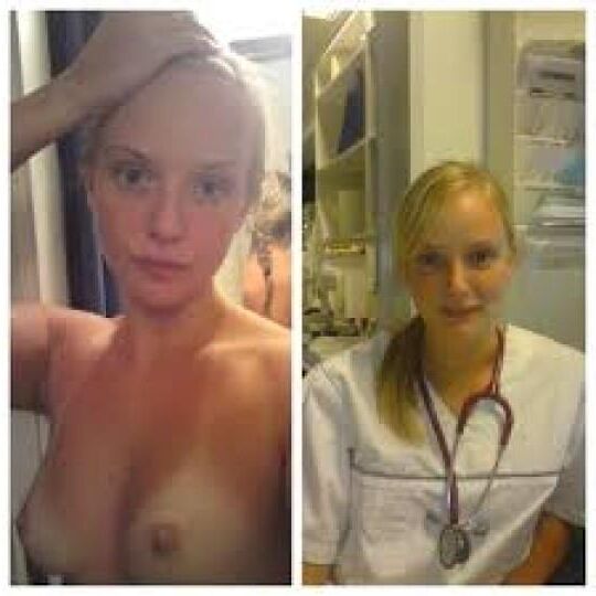 Antes e depois do OMG