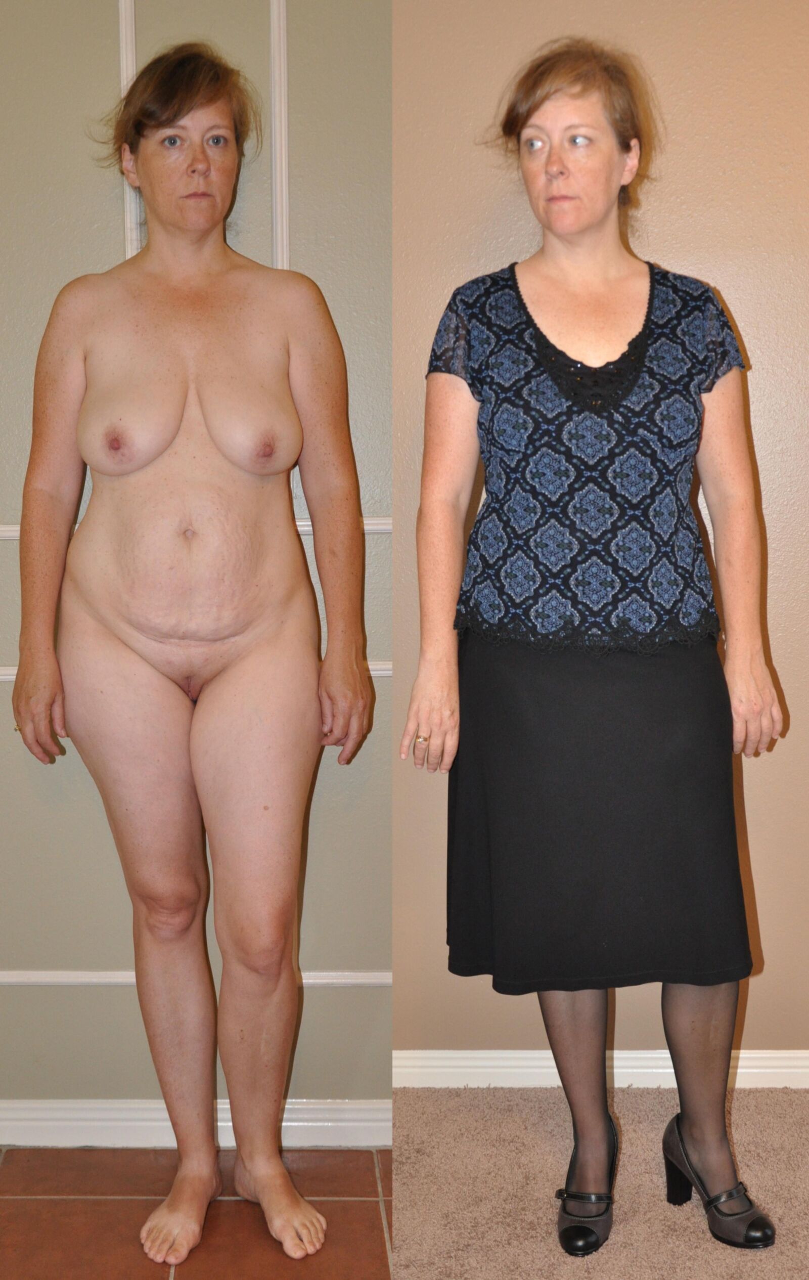 Dressed & undressed