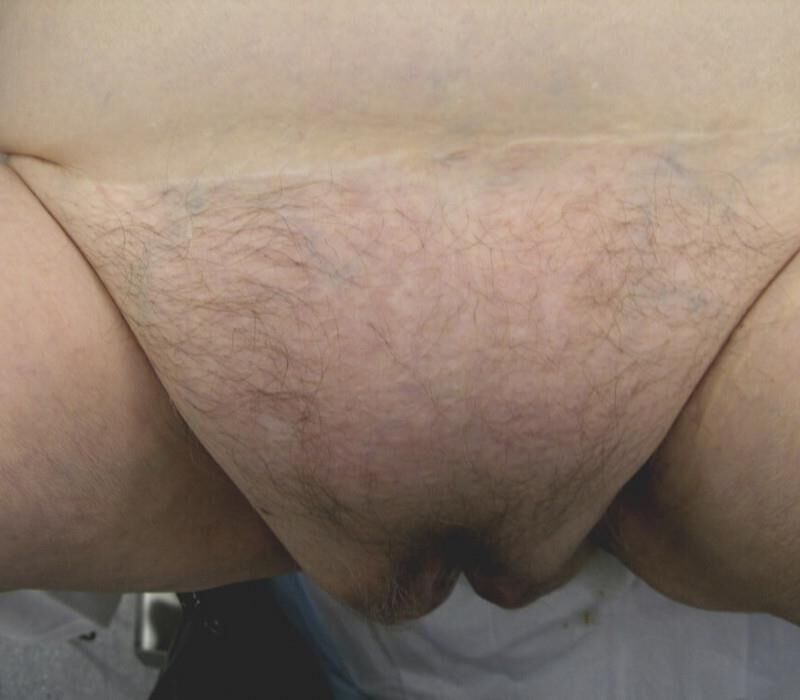 Mistura