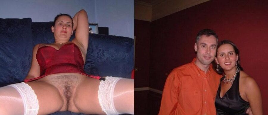 Before and After OMG 