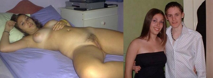 Before and After OMG 