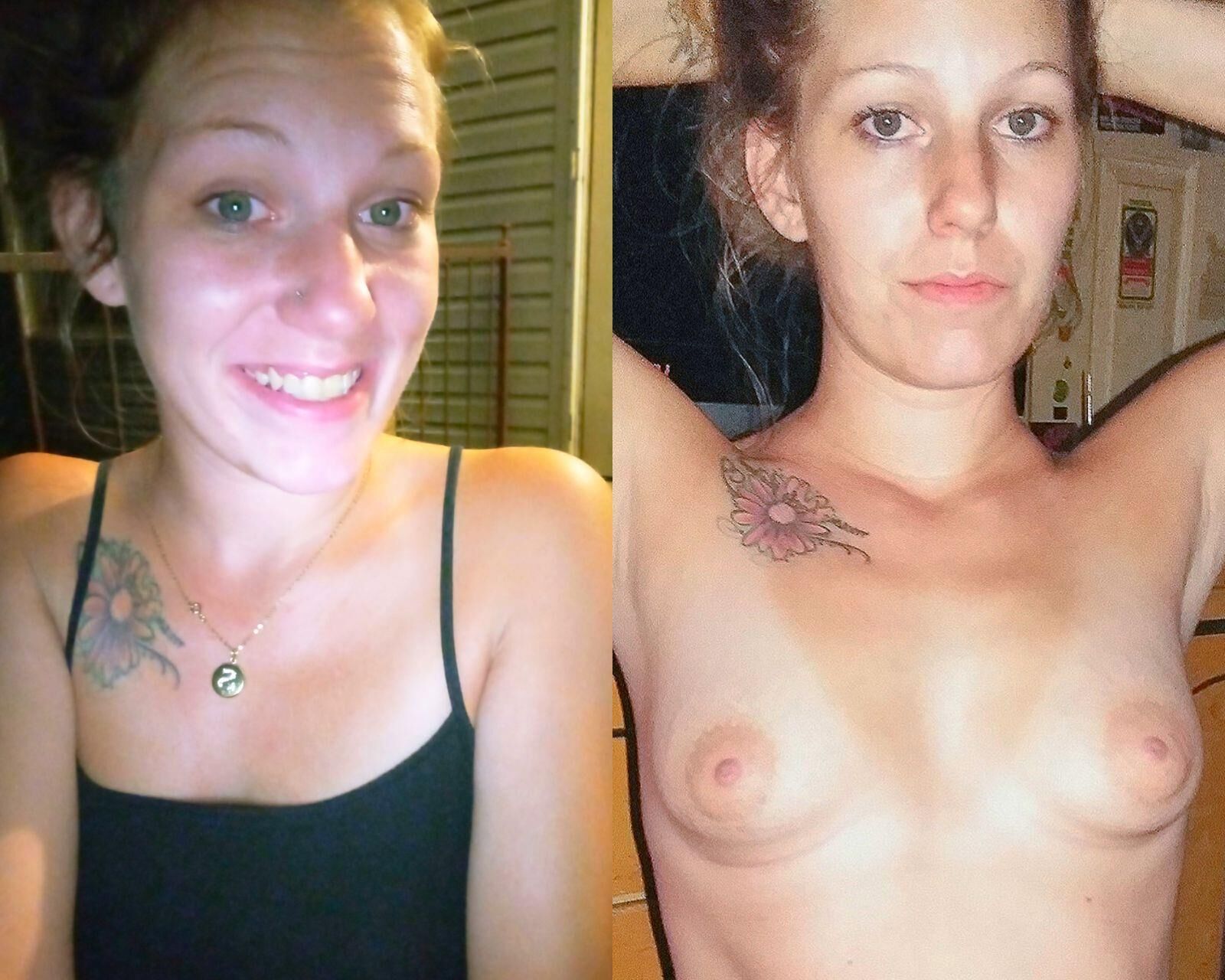 Before and After OMG 