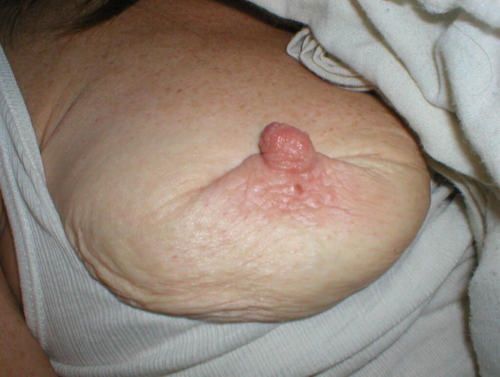 Mix
