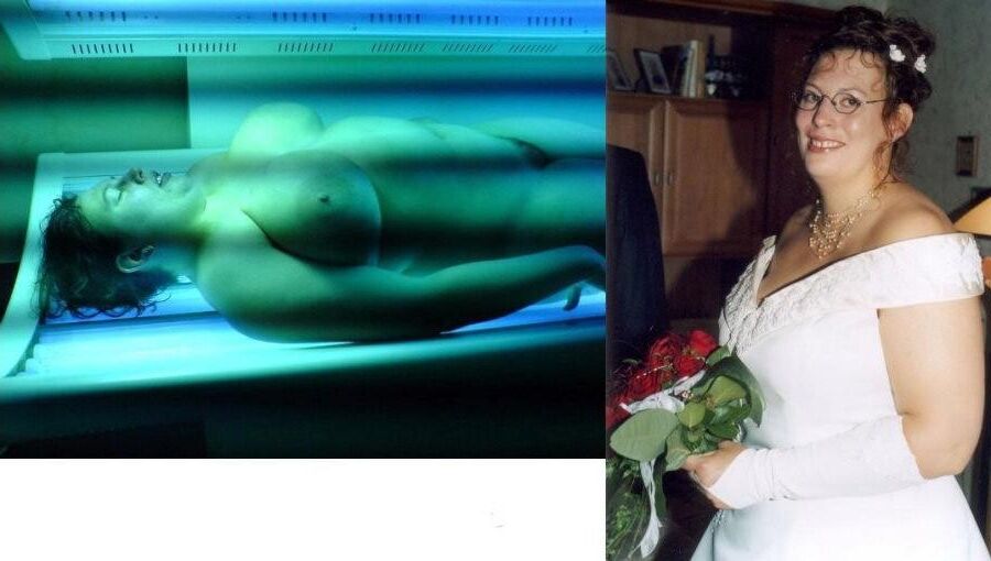Before and After OMG 
