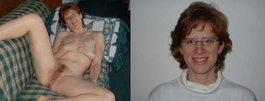 Before and After OMG 