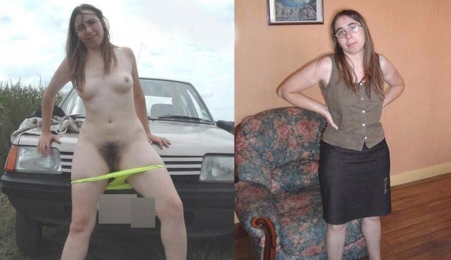 Before and After OMG 