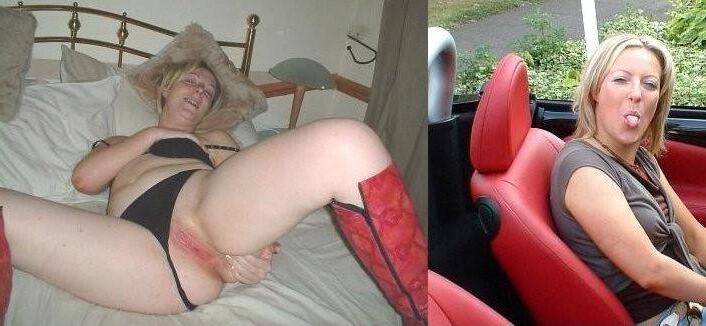 Before and After OMG 