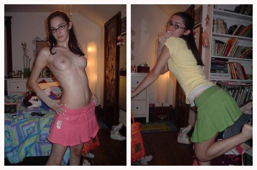 Before and After OMG 