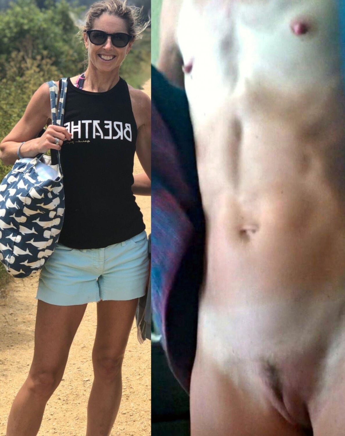 Before and After OMG 