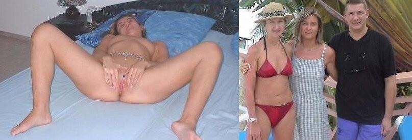 Before and After OMG 