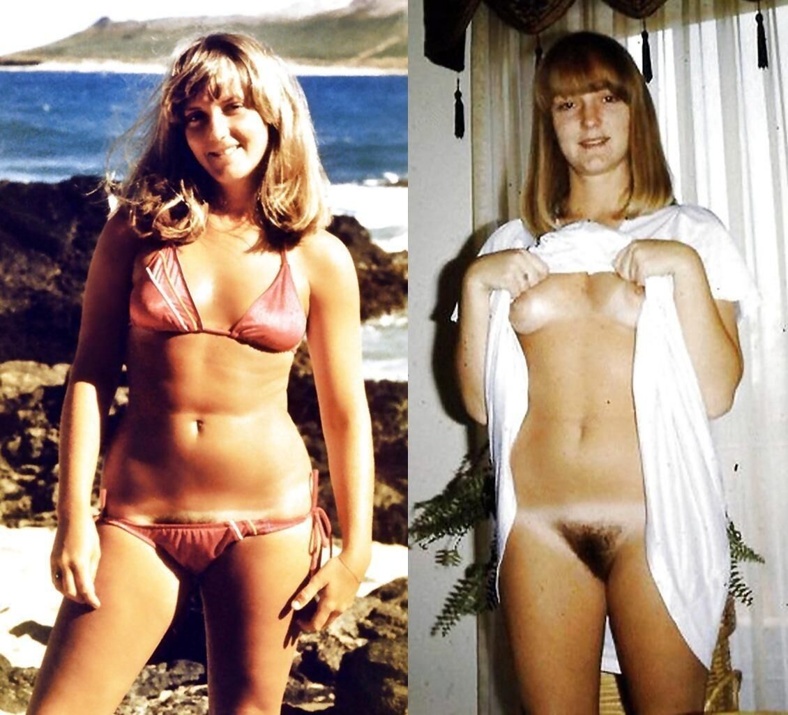 Before and After OMG 