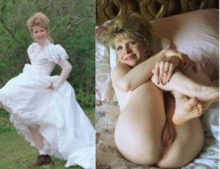 Before and After OMG 