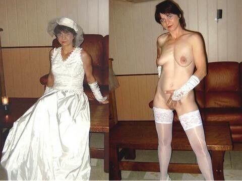 Before and After OMG 
