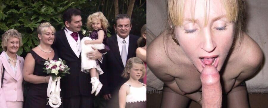 Before and After OMG 