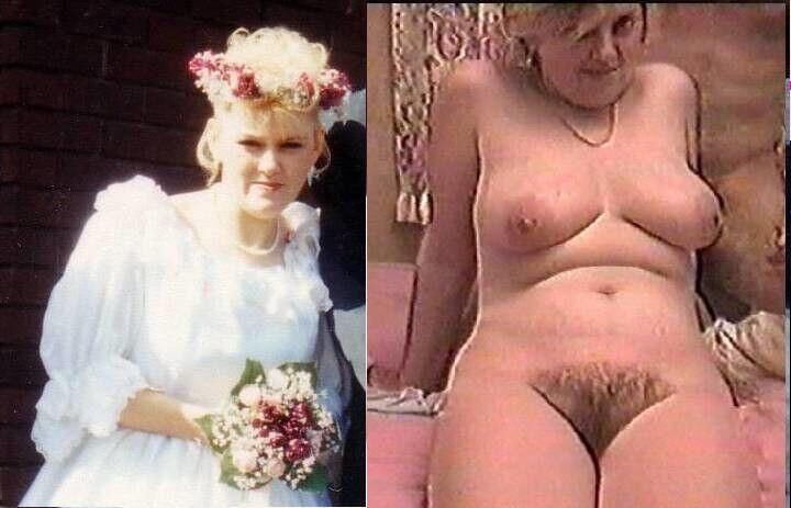 Before and After OMG 