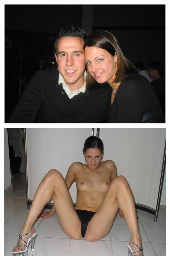 Before and After OMG 
