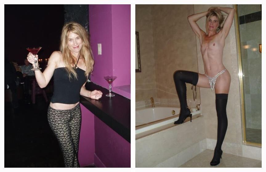 Before and After OMG 
