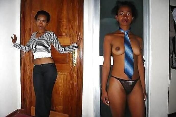 Before and After OMG 