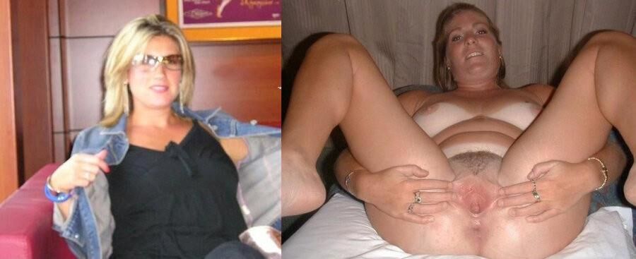 Before and After OMG 