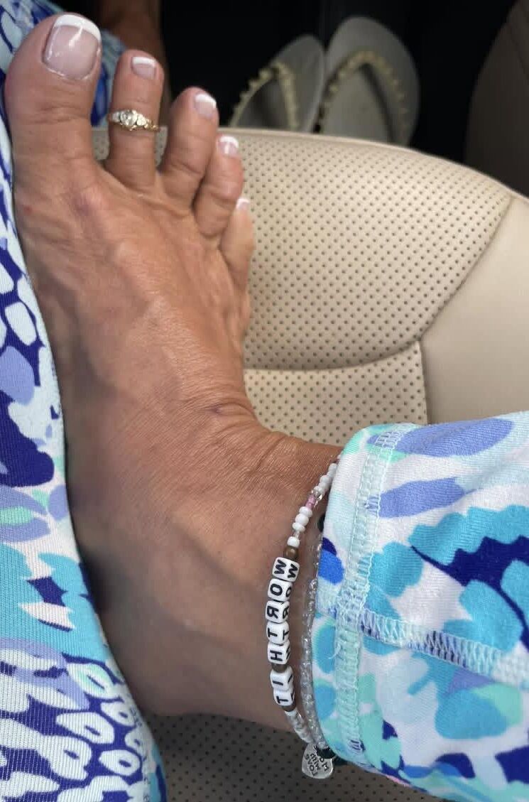  Legs, Feet and Toes