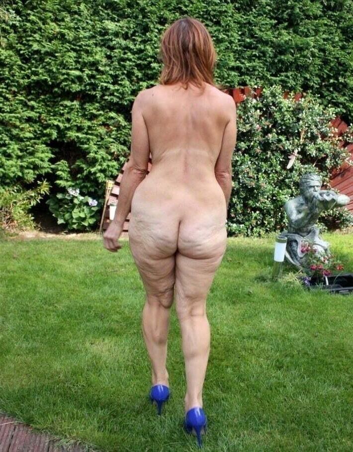 Cellulite asses and thighs ()